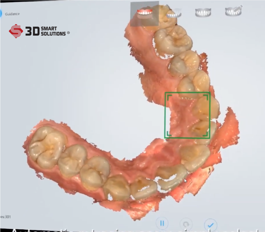 du lieu scan 3d ham rang