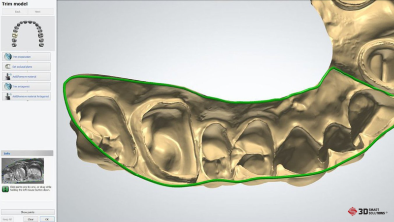 thiết kế 3d răng