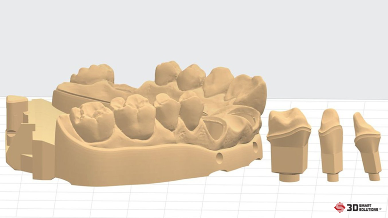 ung dung cong nghe 3d trong nha khoa