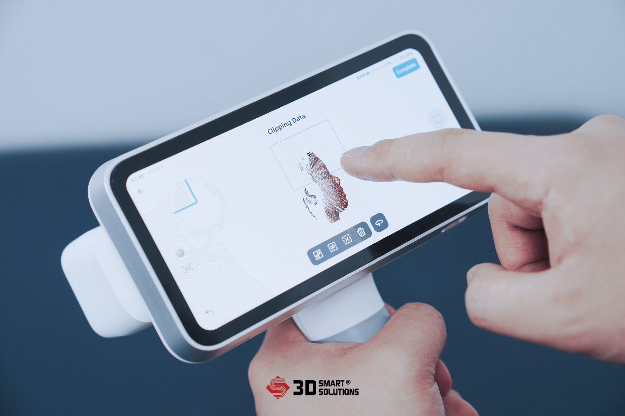 EinScan Medixa - Máy quét 3D Y Tế