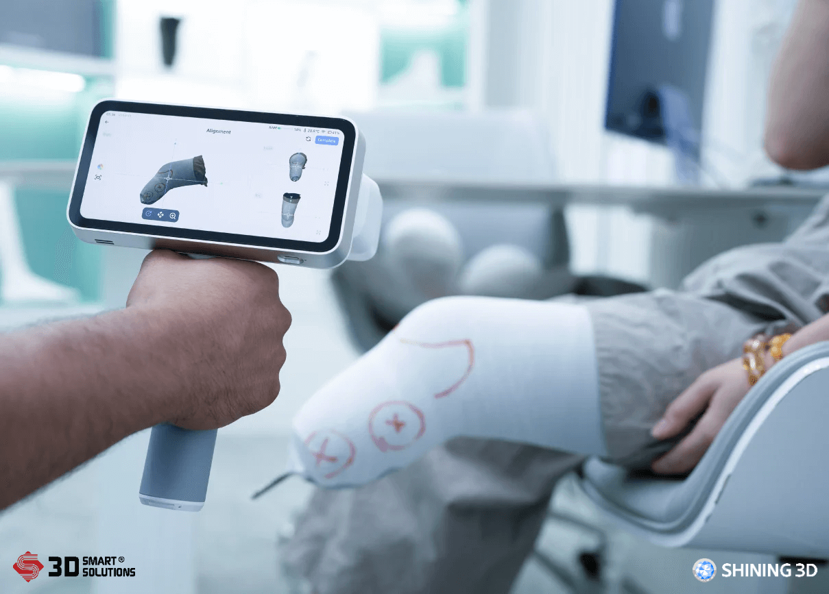 Máy Quét 3D Y Tế EinScan Medixa – Chuyên Tạo Chân Tay Giả và Chỉnh Hình